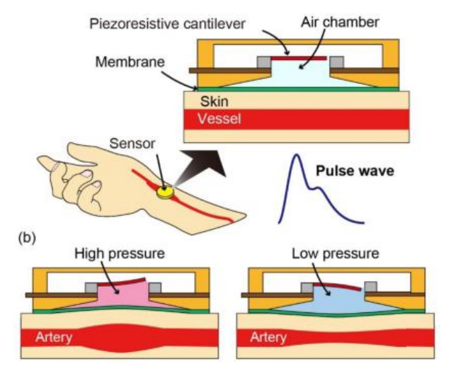 醫(yī)療行業(yè)設(shè)備實(shí)時監(jiān)控壓感油墨,能夠精確測量0-100%形變和0-1000N力范圍