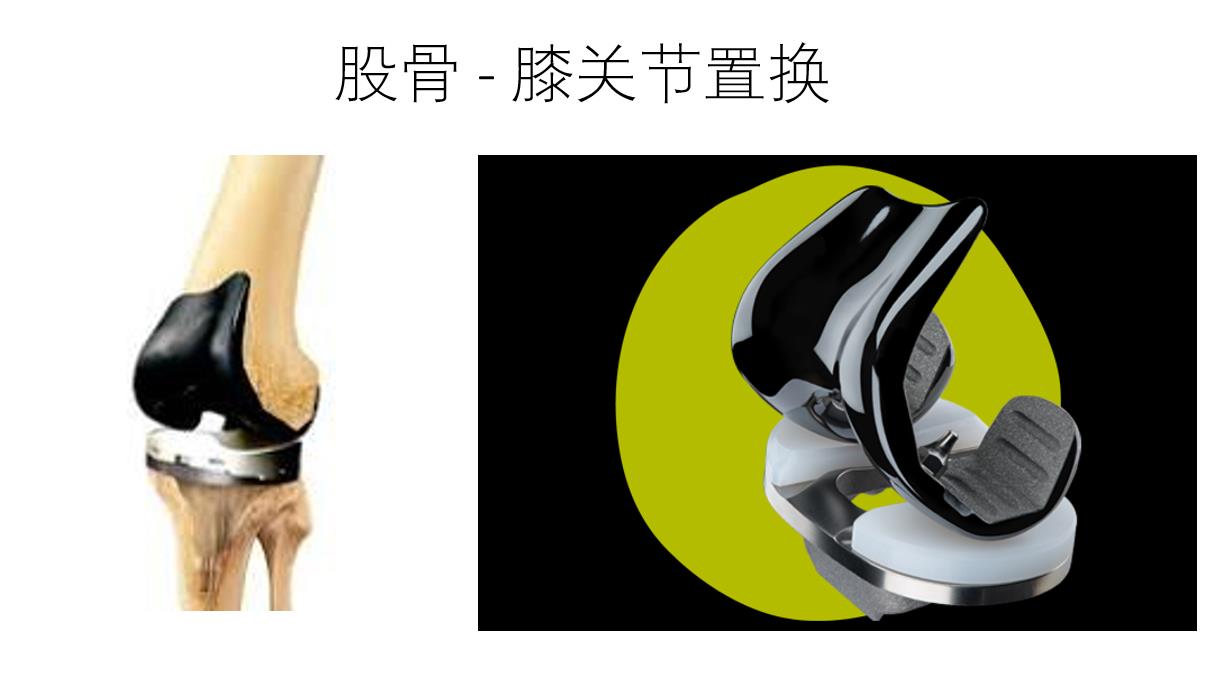 一種用于高效骨科植入物生產(chǎn)耐酸膠遮蔽材料CYB025-40Z-2G